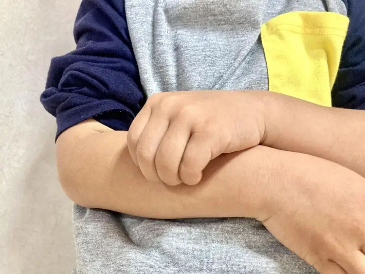 ダニに刺されやすい人には共通点がある？