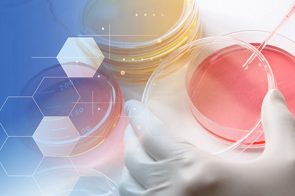 Cell culture