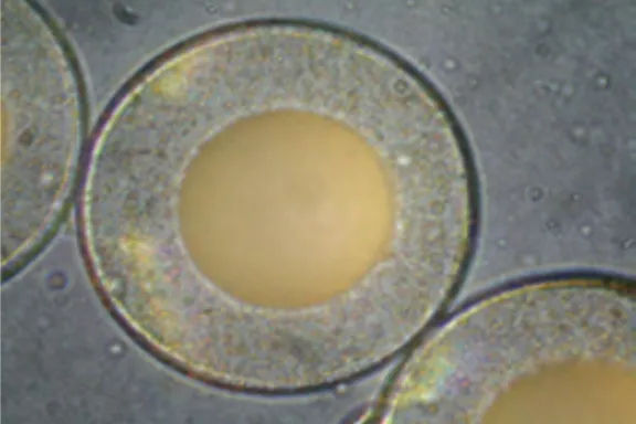 エクステージ®