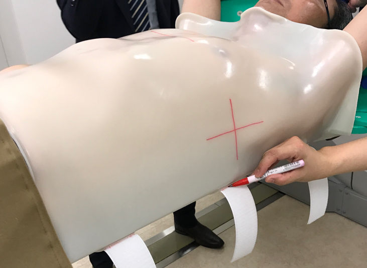 Radiotherapy positional fixation sheets; Flexible reproducibility/customization according to the patient's fixation site